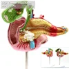 ENOVO/ VISCERA- Pathological Model of the Pancreas, Duodenum and Gallbladder ,Digestive System Medical Anatomical Models, 12541