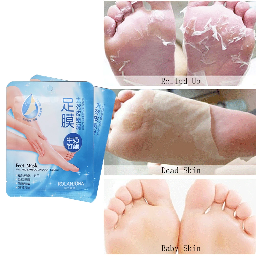 baby feet callus remover