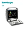 /product-detail/sonoscape-portable-ultrasound-for-abdoment-cardiovascular-and-cardioc-checking-laptop-doppler-device-60809102710.html
