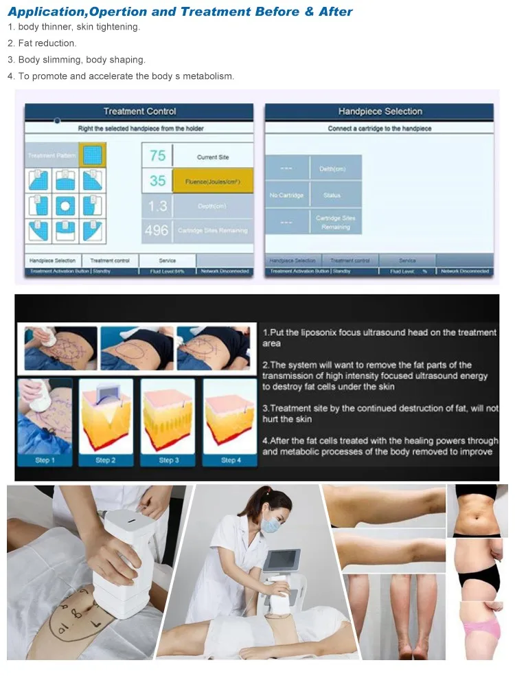 2016 Hottest Promotion!!! liposonix hifu slimming equipment/liposonix machine