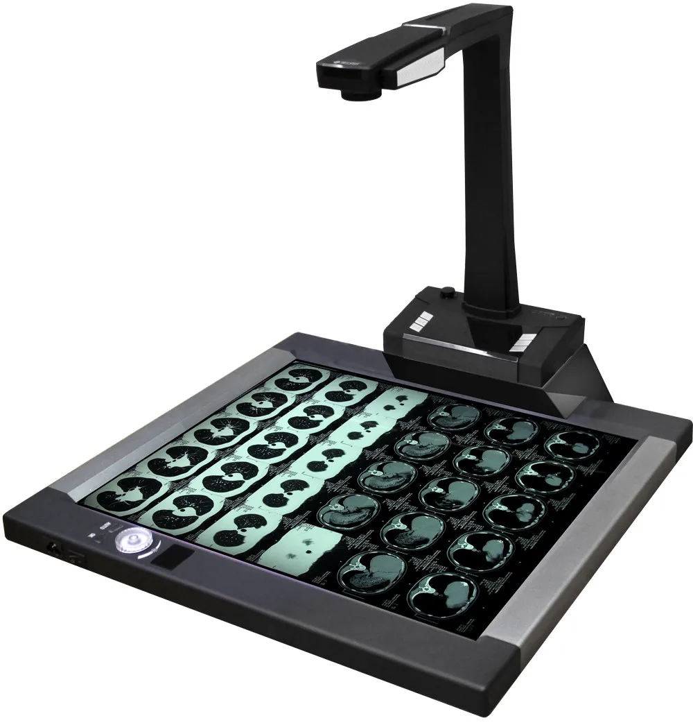 Joyusing Ct160 Xray Film Scanner For Hospital And Clinic Diagnosis Buy Ct Film Scanner,Dental