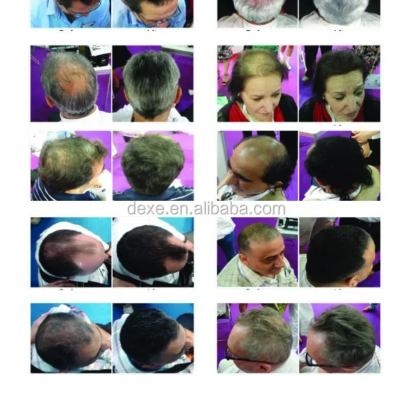 Dexe Hair Building Fibre Oem Hair Building Fiber Hair Loss