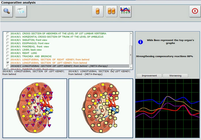New bio resonance 18D NLS hunter body health analyzer with multi-language