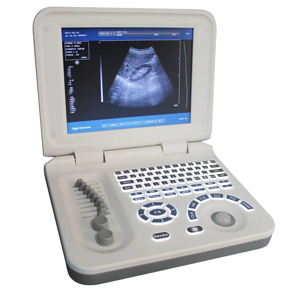 Factory Price Portable Ultrasound Machine / Mslpu26 Laptop Digital