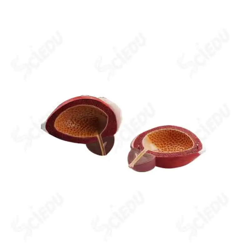 gold marker prostata gold marker prostata