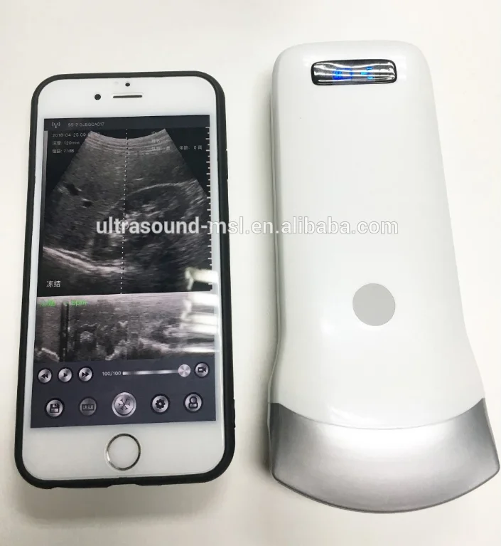 Factory price China wireless ultrasound probe ipad portable ultrasound