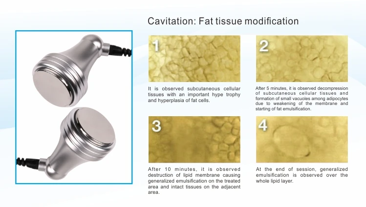Fat Reduction Buttock Lifting Body Contouring Slimming Machine Velashape V10