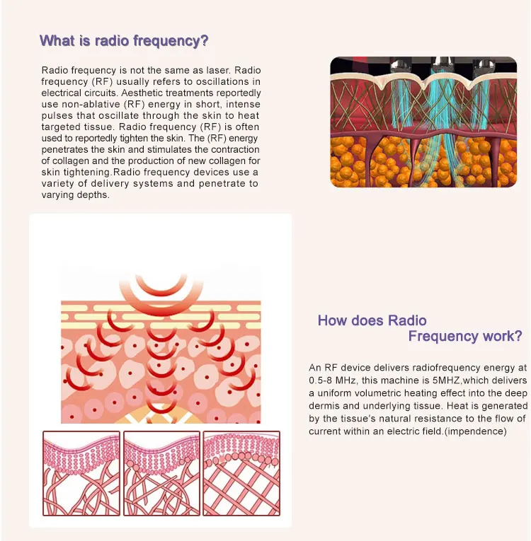 Best Home Rf Skin Tightening Face Lifting Machine Portable Rf Machine Home Product on Alibaba