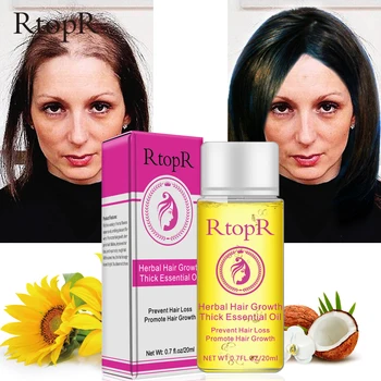 Rtopr Hair Care Natural Organic Hair Loss Treatment Herbal Wild