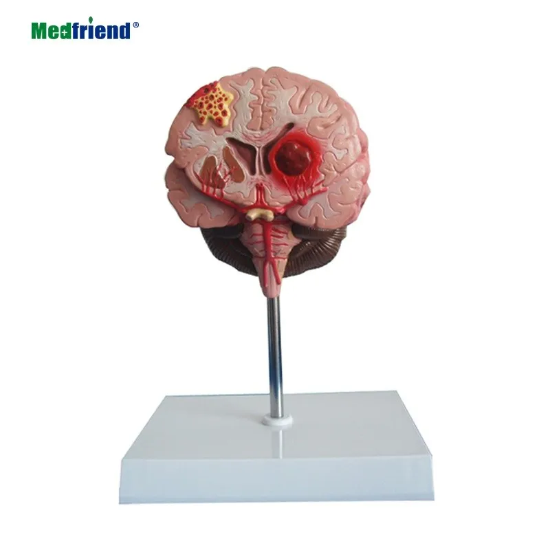 产品名称: 先进工厂解剖脑中风模型脑瘫脑肿瘤脑疾病模型神经病学脑