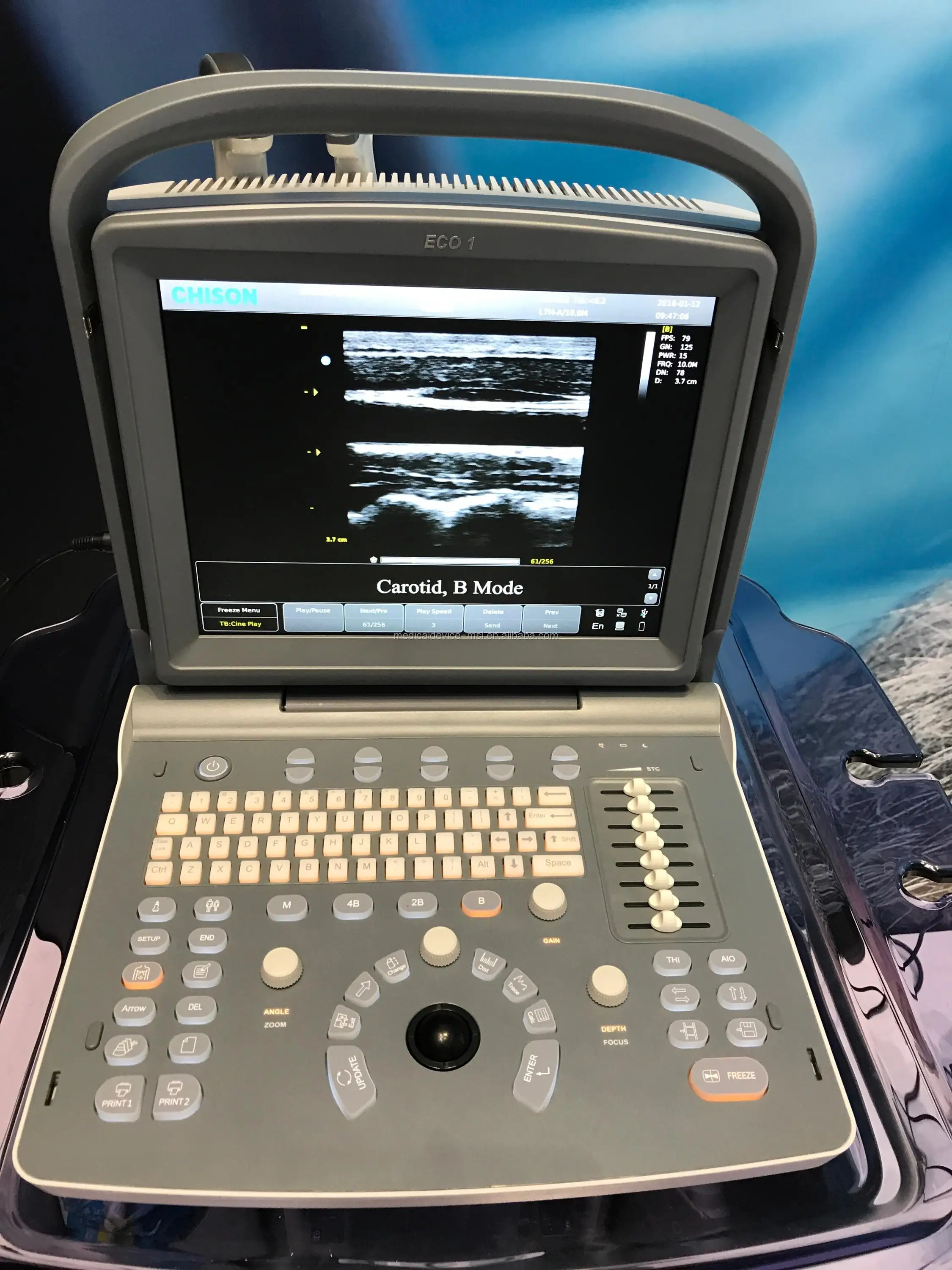 CE & ISO 2D b/w portable ultrasound scanner Chison eco1 ultrasound