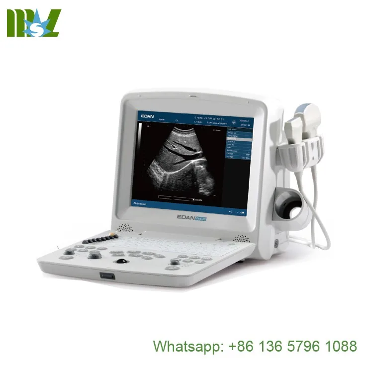 Edan Ultrasound Machine Ultrasound Portable Edan Dus 60 Buy Edan Ultrasound Edan Dus 60 Ultrasound Portable Edan Dus 60 Product On Alibaba Com