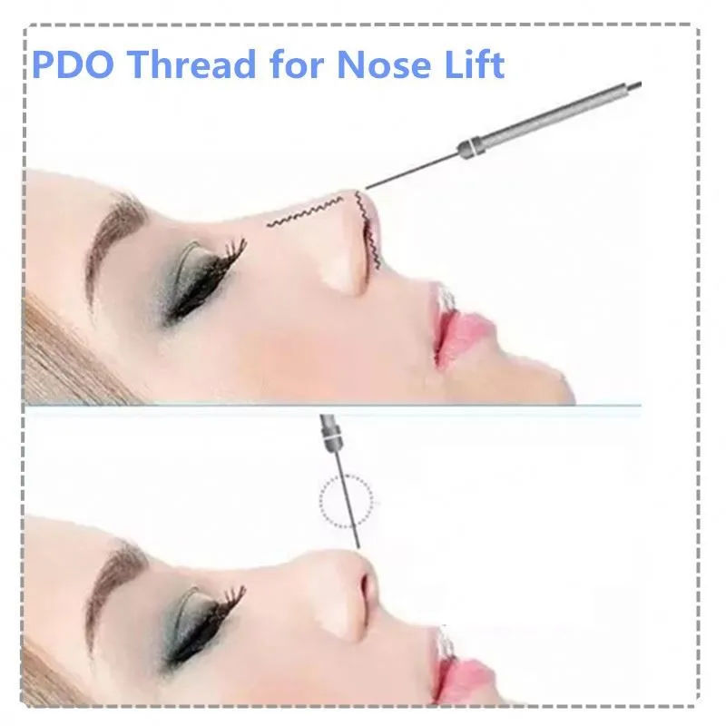 pdo nose thread lift