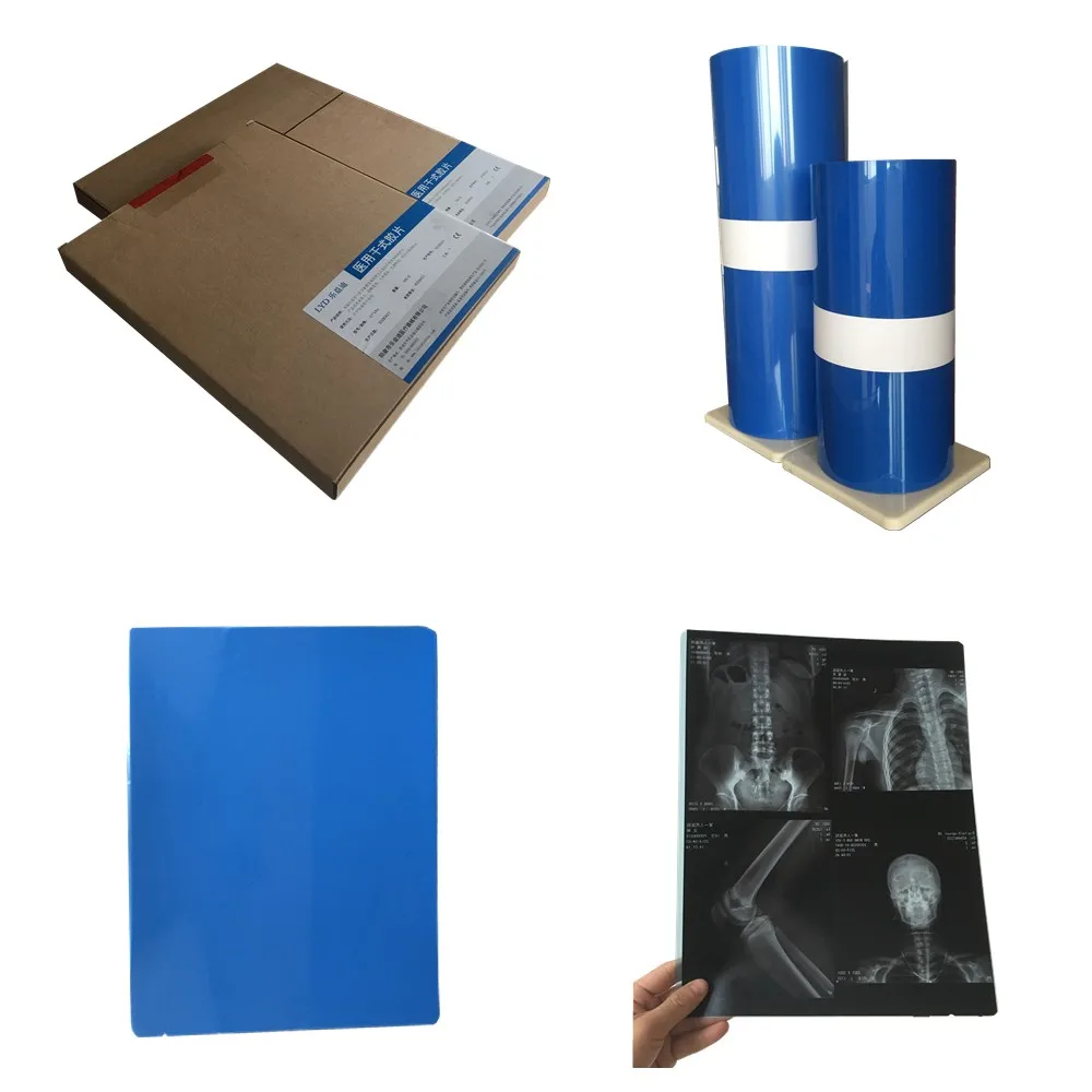 Thermal Medical Xray Films 14x17 / 35x43 Equivalent To Agfa Dt2b Buy