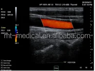 Portable Ultrasonic Diagnostic Devices Type Ultrasound Machine For Pregnancy