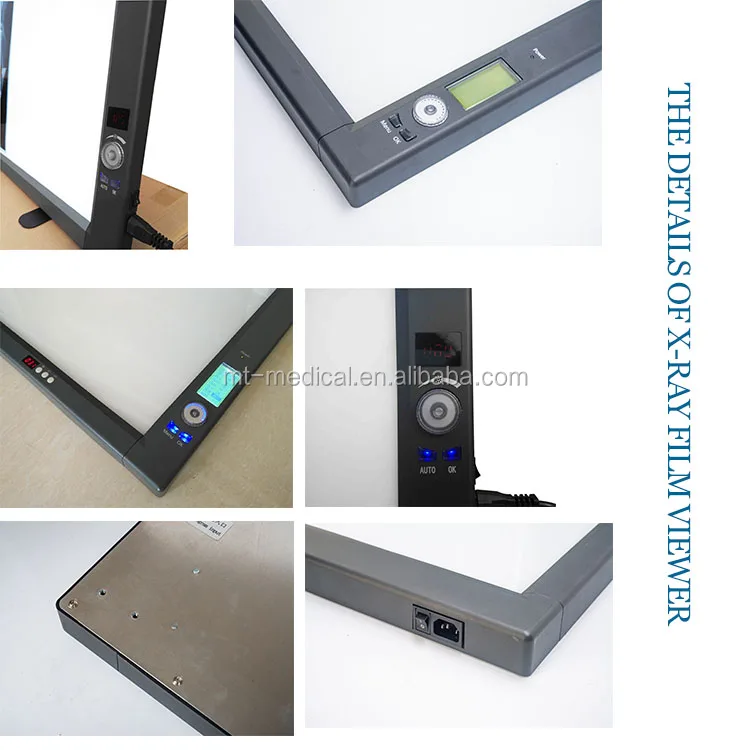 Most New models of ultrathin LED x-ray film viewer for public use and special for hospital