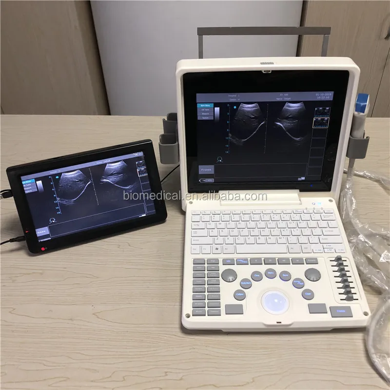 High Frequency Portable Ultrasound Machine Conversion Notebook B/W