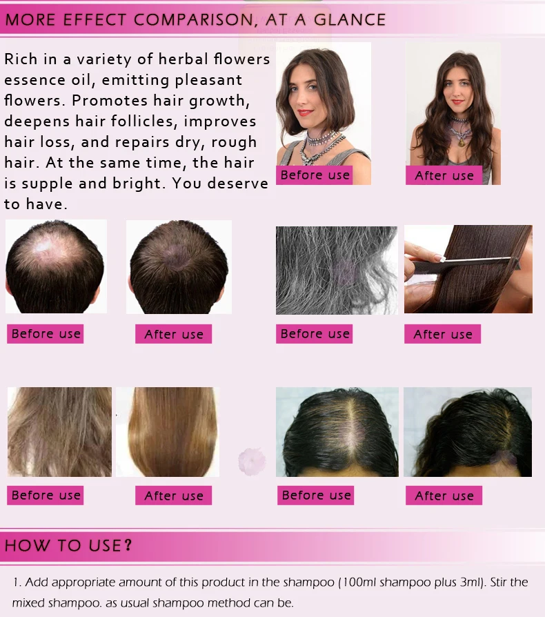 Hair Loss Prevention Treatment For Men Women With Thinning Hair