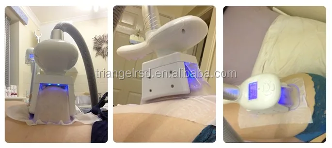 Body slimming machine freeze fat/cryolipolysis beauty equipment/slimming cryolipolisis on sale