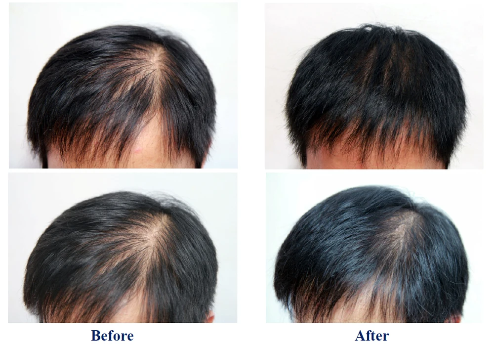 China Hair Treatment Oem Wholesale Alibaba