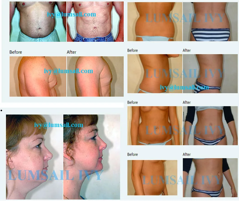 before after.jpg