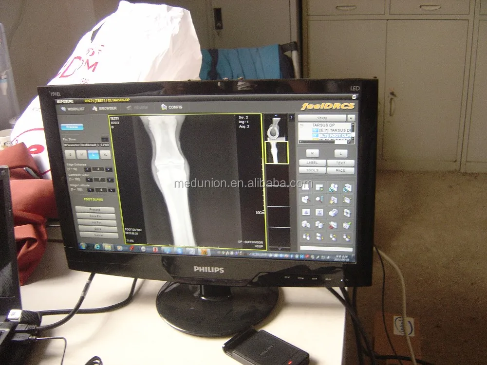 2018 New Advanced Upgraded X Ray Machine Mslpx04 Portable Digital High Frequency Xray Machine