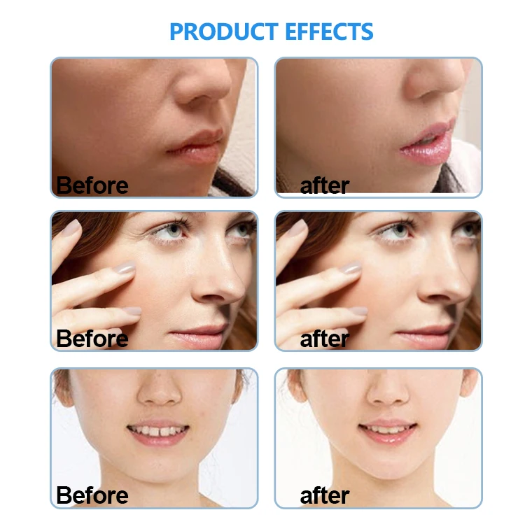 New Arrival Microcurrent Skin Tightening Face Lifting Machine with LED therapy(8).jpg