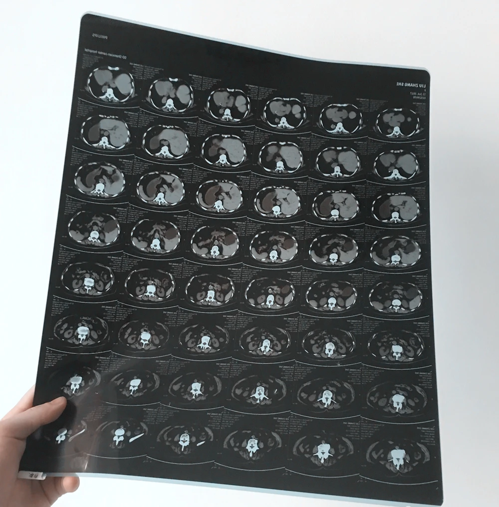 Medical X Ray Film Blue Sensitive 35x43 Cm For Laser Printer Buy