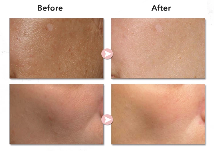 02Retinol  Cream