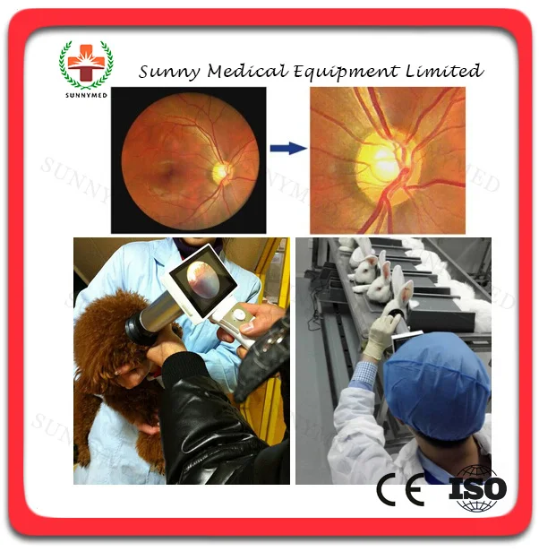 sy v042 best quality hand held fundus camera hfc medical ophthalmology diagnosis fundus camera - Best Camera For Medical Photography sy v042 best quality hand held fundus camera hfc medical ophthalmology diagnosis fundus camera - Best Camera For Medical Photography
