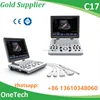 11Mhz high frequency / 96 element crystal clear image color doppler ultrasound machine/scanner C17