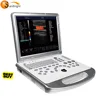100% return policy! High quality Echo color doppler 4D function doppler machine