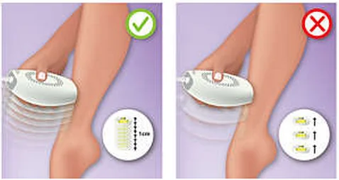 IPL SHR /SHR IPL /IPL hair removal, professional laser hair removal machine