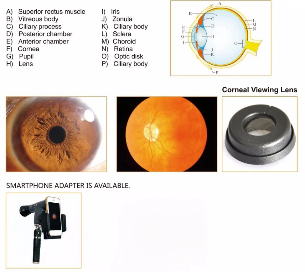 Mce800 Rechargeable Ophthalmic Pantoscopic Ophthalmoscope/ophthalmic