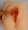 Reusable vulva suture training model
