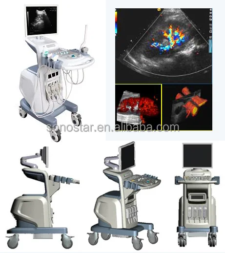
Color Ultrasound Doppler Machine with Trolley SS-2000 Sonostar Manufacturer 