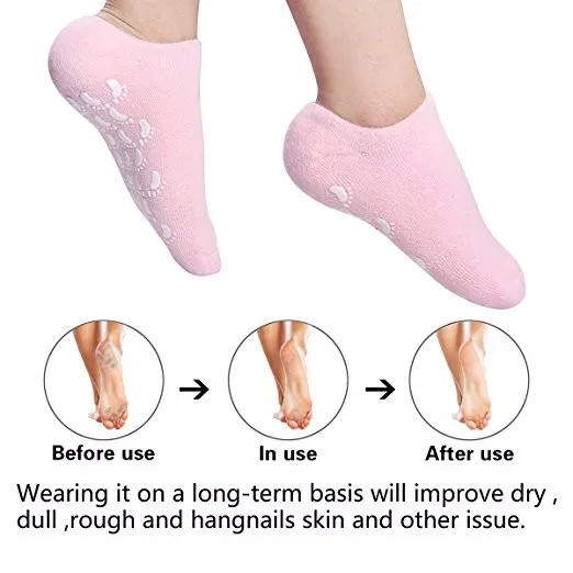 Moisturizing Gel Heel Socks Day Night Toe Open Feet Care Sets Ultimate
