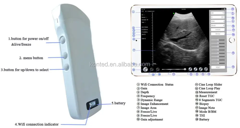 Konted Gen4pro 192 Elements 7.5/10mhz Wireless Linear Probe Ipad/iphone