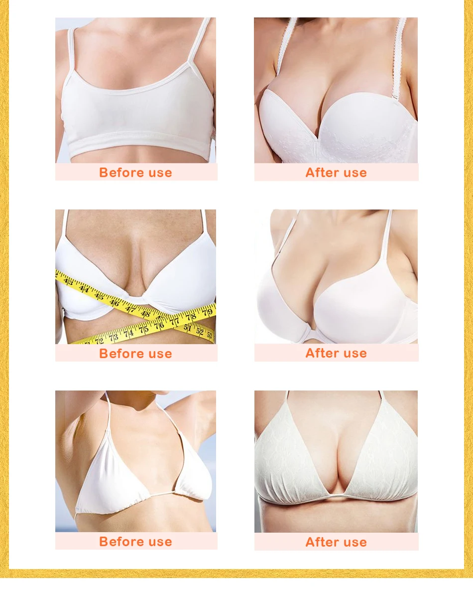 Female Breast Mask Silicone Breast Mask Bosom/udder/bust Enlargement