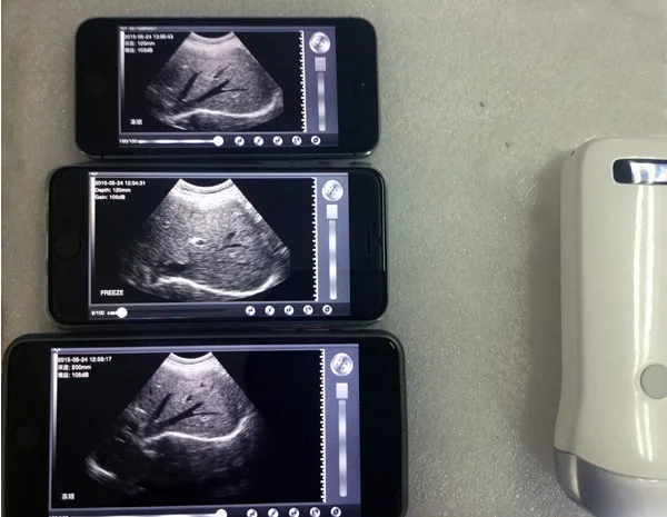 Sonostar Manufacturer Supplies Portable Wireless Wifi Ultrasound Probe ...