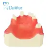 Fantastic Quality Dental Implant Practice Model Upper Dental Model for Dental Students
