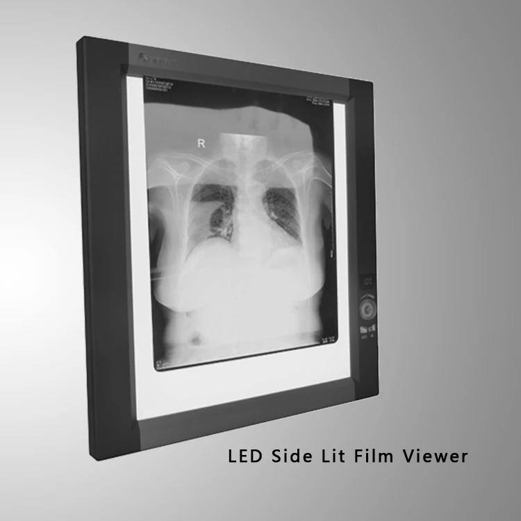  ultra slim x ray film digitizer led lights radiograph viewer.jpg