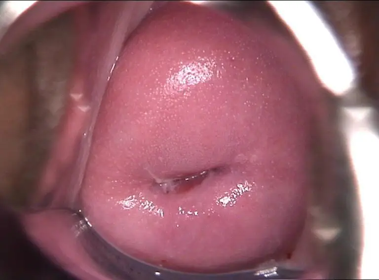 Penis Inside Vagina Cam 77