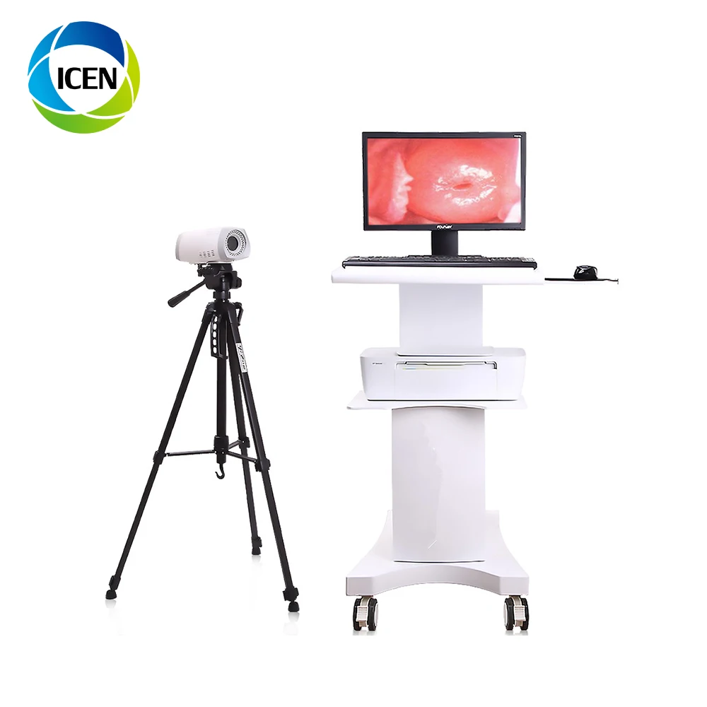 hd vagina colposcope