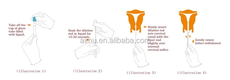 Laminaria Cervical Dilator