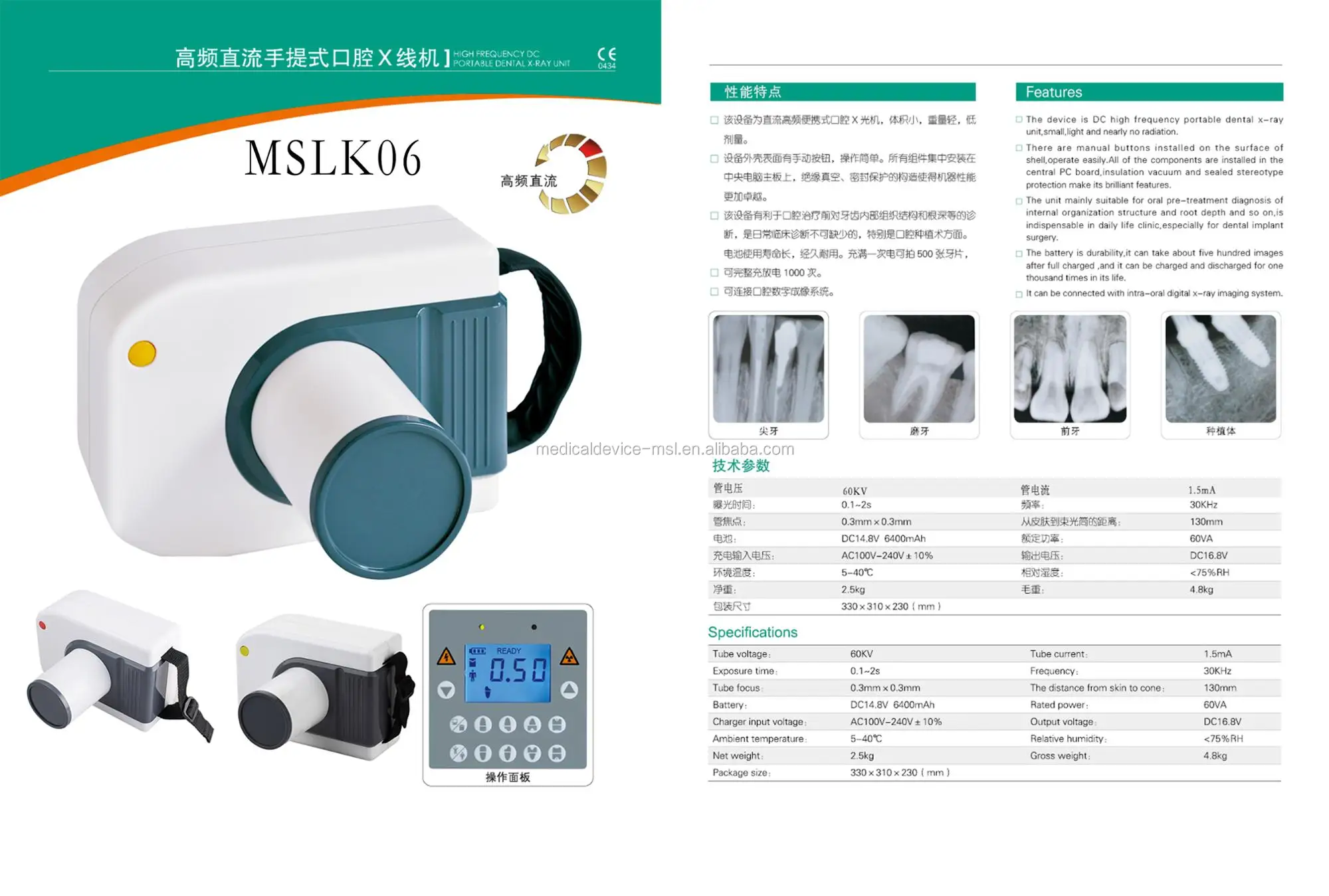 專業牙科 x光機/高頻便攜式 xray 為臨床使用