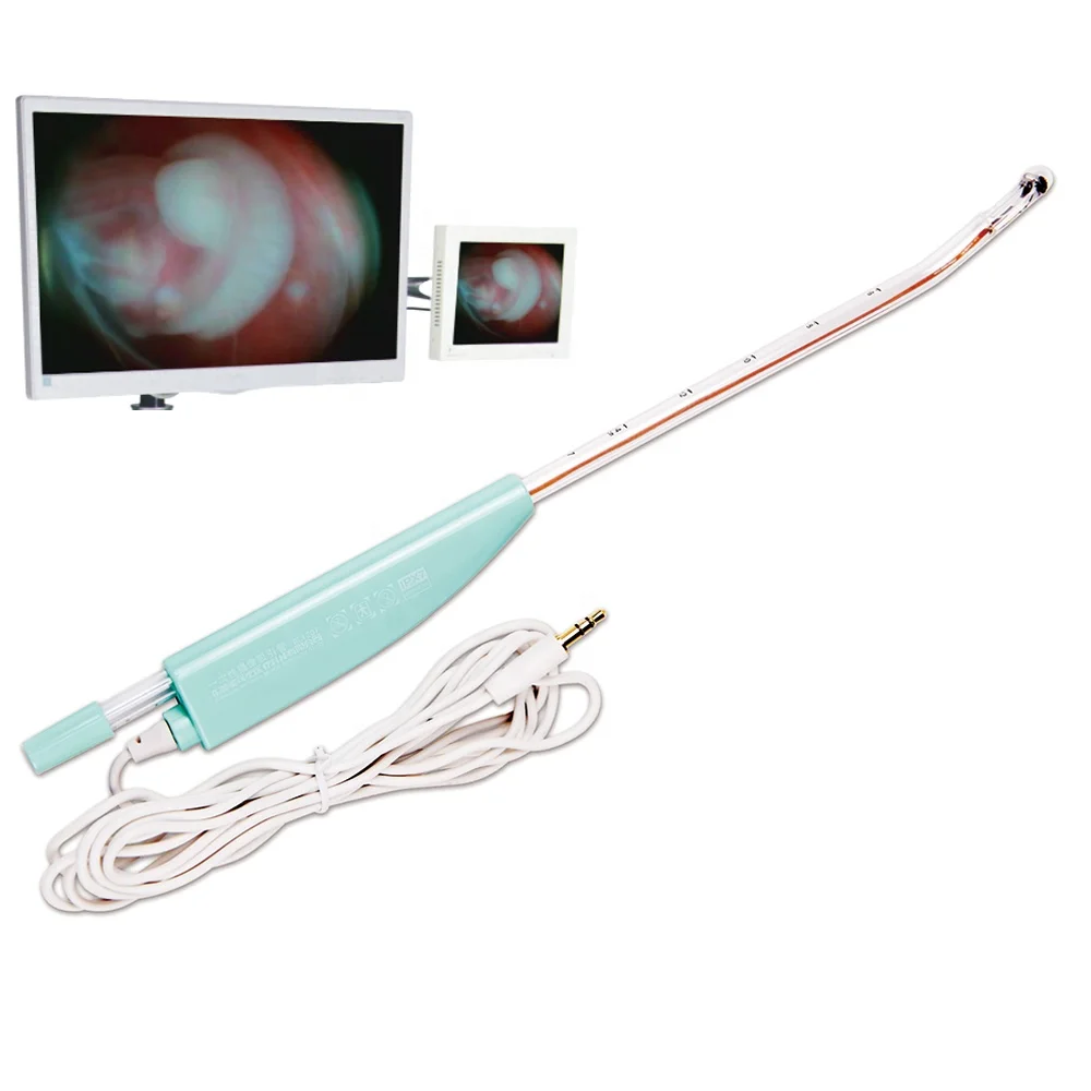
disposable visual endoscopic suction cannula with optical camera for surgical abortion 