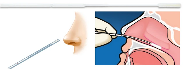 Соскоб ротоглотки. Назофарингеальный мазок. Мазок на ковид.