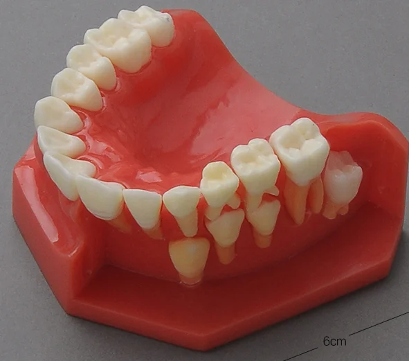 Mixed Dentition Pediatric Development Model: Age 9