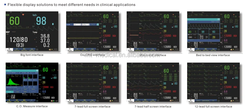Hospital Equipment Multiparameter Patient Monitor Price For Sale